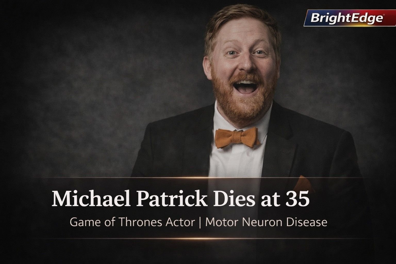 Michael Patrick, Irish actor who appeared in Game of Thrones, who died at 35 from motor neurone disease